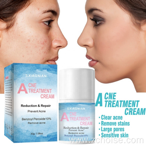 best pimple acne cream for face